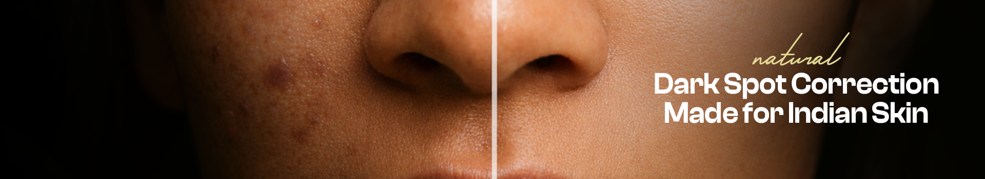 collection-banner-image